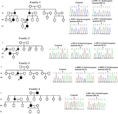 A Novel α-Galactosidase A Splicing Mutation Predisposes to Fabry Disease